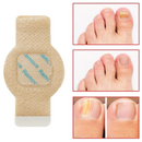 NailHeal™ - Parches para hongos en las uñas 🌿💅