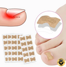 Pack x50 parches corrector Uñas Encarnadas