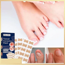 Pack x50 parches corrector Uñas Encarnadas