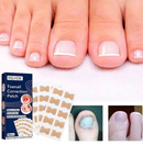 Pack x50 parches corrector Uñas Encarnadas