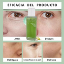 SERUM DE NONI COREANO - PREVIENE ARRUGAS Y AYUDA A CALMAR EL ACNÉ